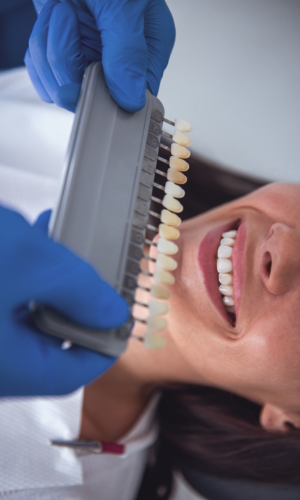Veneer colors are compared with a patient's natural teeth