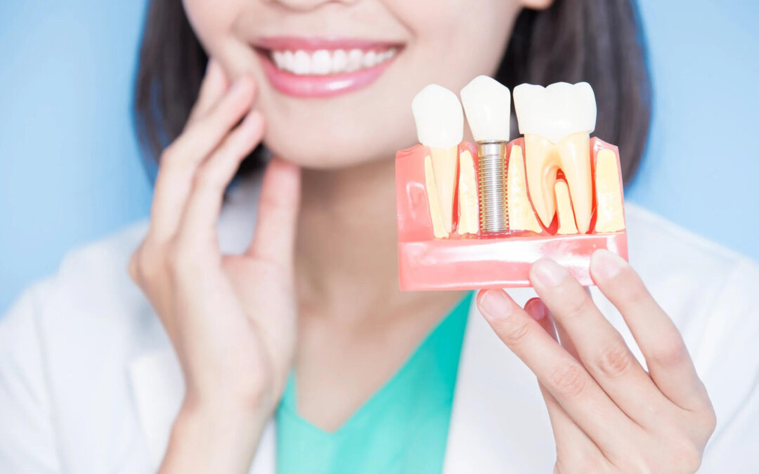 Unlocking Your Smile: Exploring Dental Implant Payment Plan Options